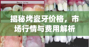 揭秘烤瓷牙价格，市场行情与费用解析